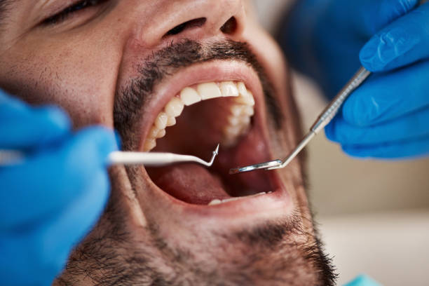 Best Oral Cancer Screening  in Shenandoah Farms, VA